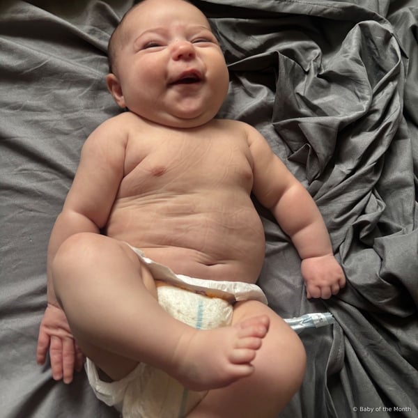 Anya - Contest Entry Photo