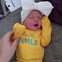 Aurelia photo 2