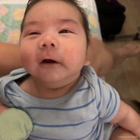 Calix photo 2
