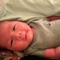 Calix photo 3